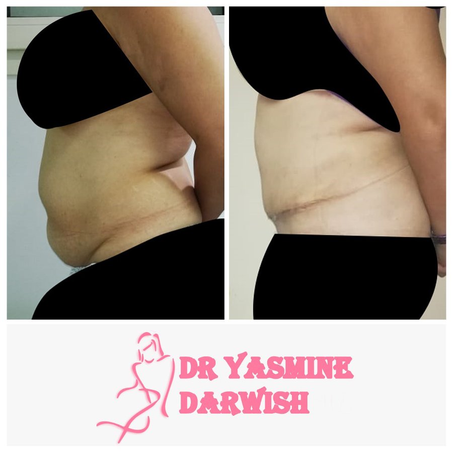 Yasmine Darwish plastic surgery clinic - Yasmine Darwish plastic surgery clinic