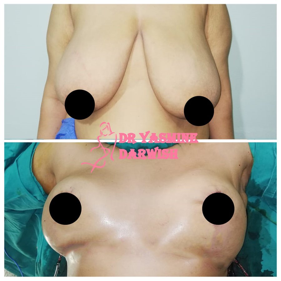 Yasmine Darwish plastic surgery clinic - Yasmine Darwish plastic surgery clinic