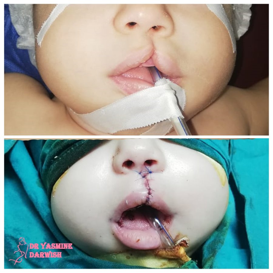 Yasmine Darwish plastic surgery clinic - Yasmine Darwish plastic surgery clinic