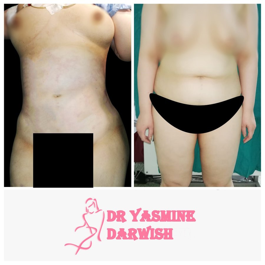 Yasmine Darwish plastic surgery clinic - Yasmine Darwish plastic surgery clinic