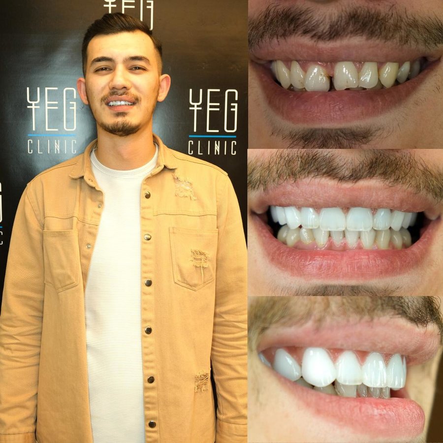 YEG Clinic - YEG Clinic