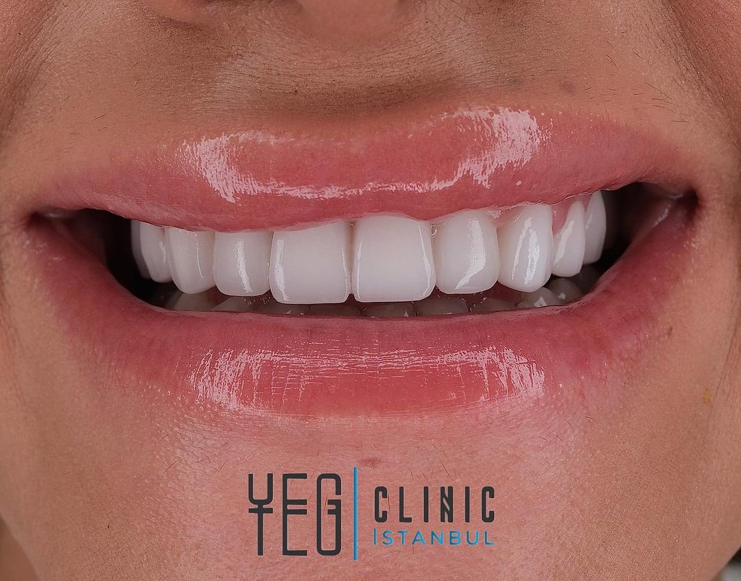 YEG Clinic - YEG Clinic