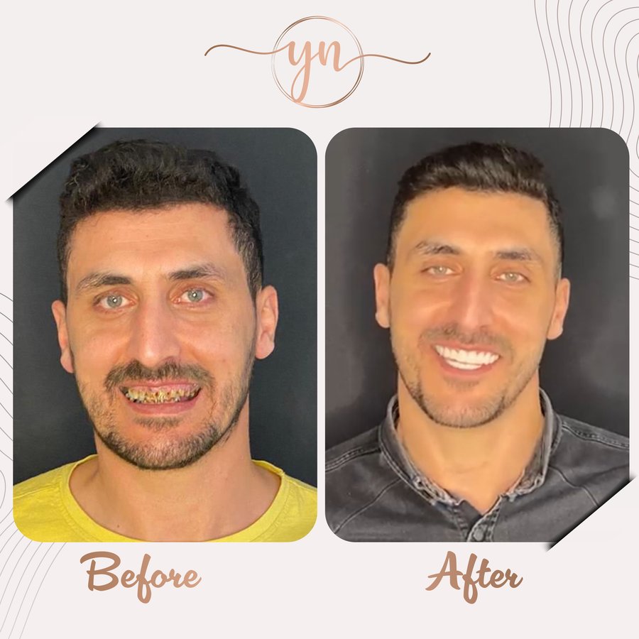 Yeni Nesil Dental Health Clinics - Yeni Nesil Dental Health Clinics