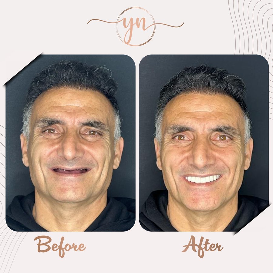 Yeni Nesil Dental Health Clinics - Yeni Nesil Dental Health Clinics