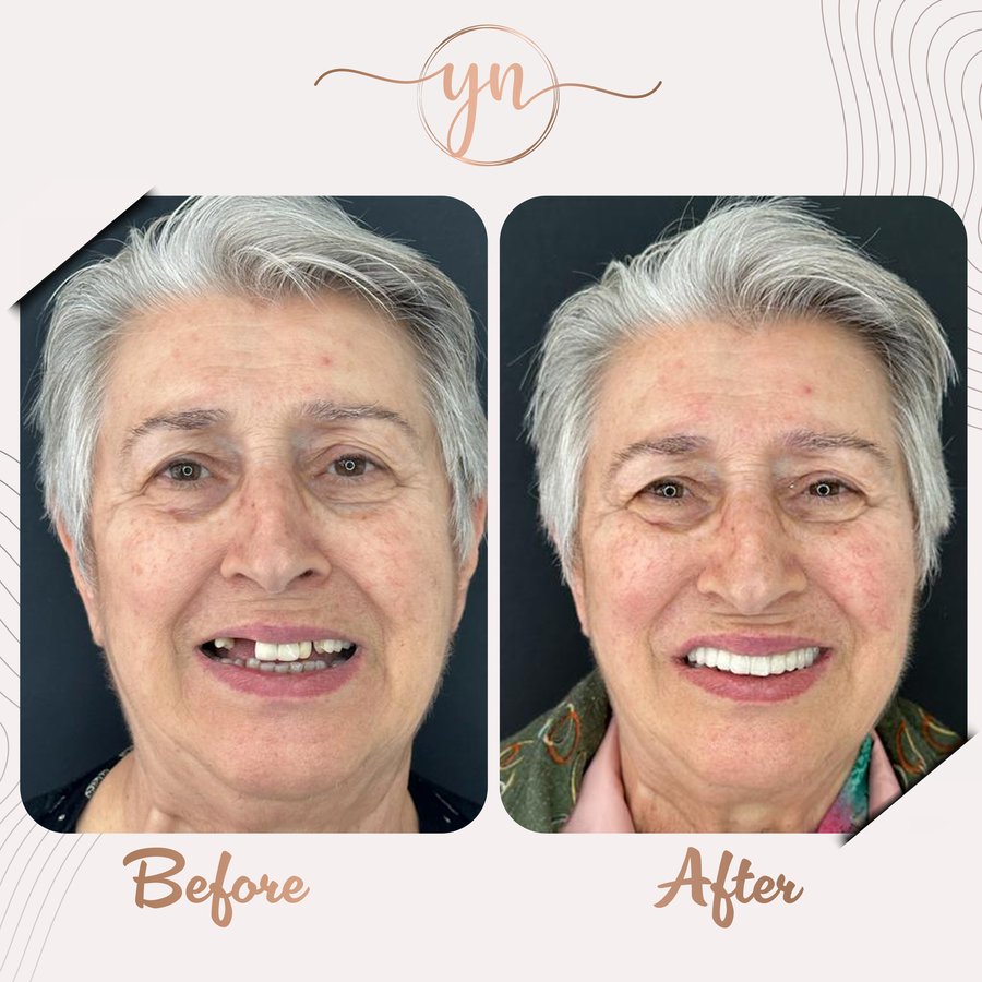 Yeni Nesil Dental Health Clinics - Yeni Nesil Dental Health Clinics