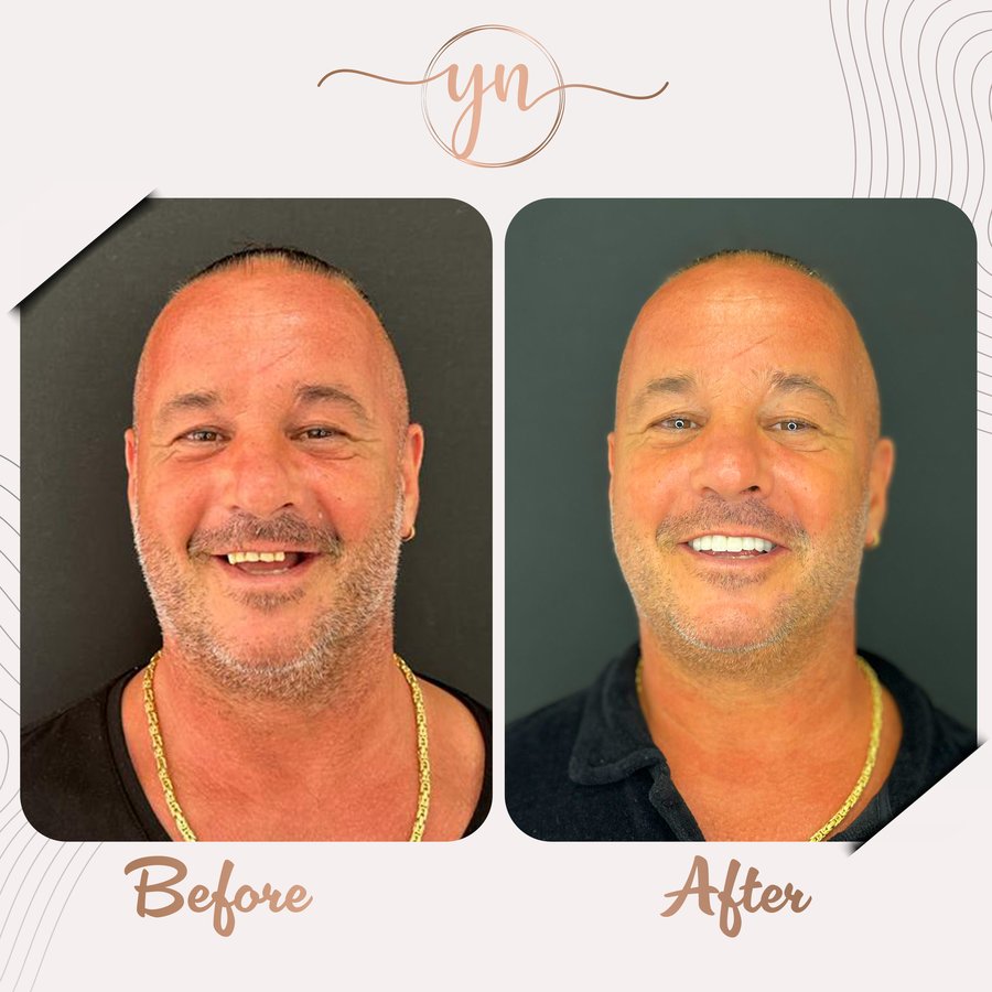 Yeni Nesil Dental Health Clinics - Yeni Nesil Dental Health Clinics