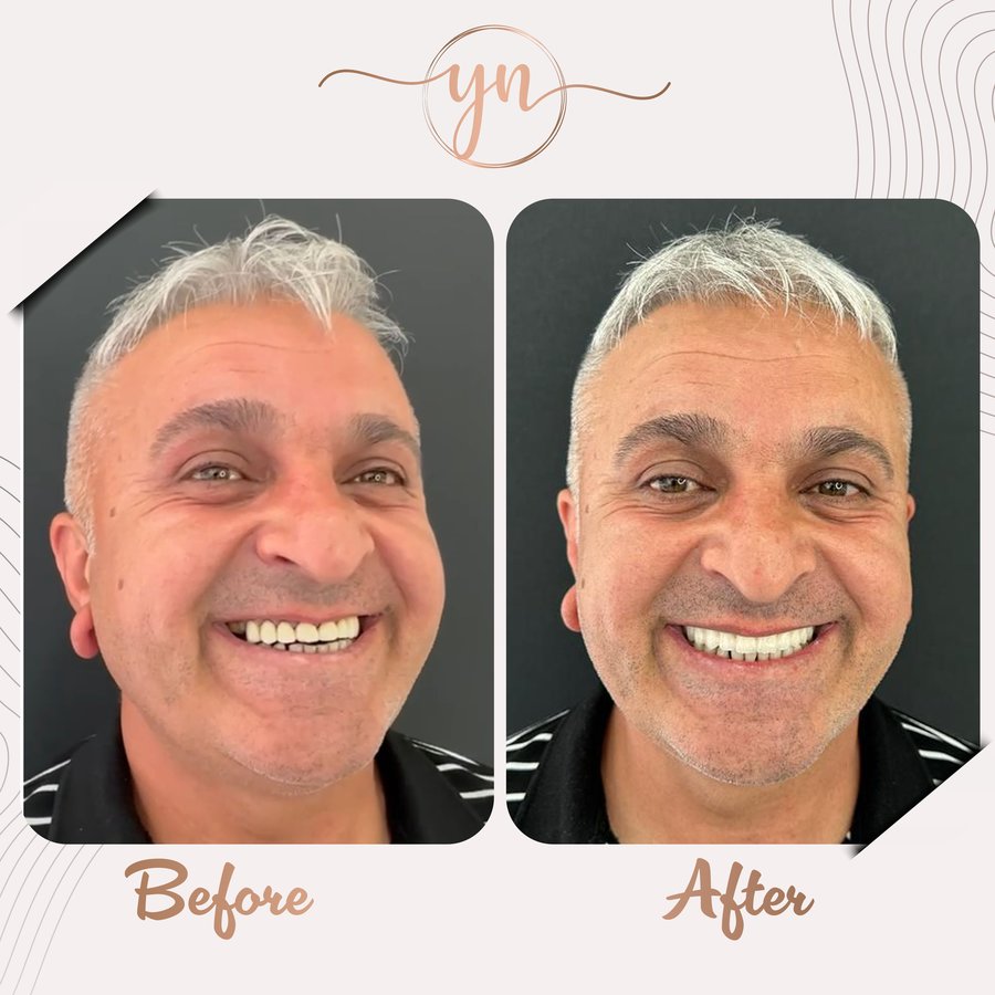 Yeni Nesil Dental Health Clinics - Yeni Nesil Dental Health Clinics