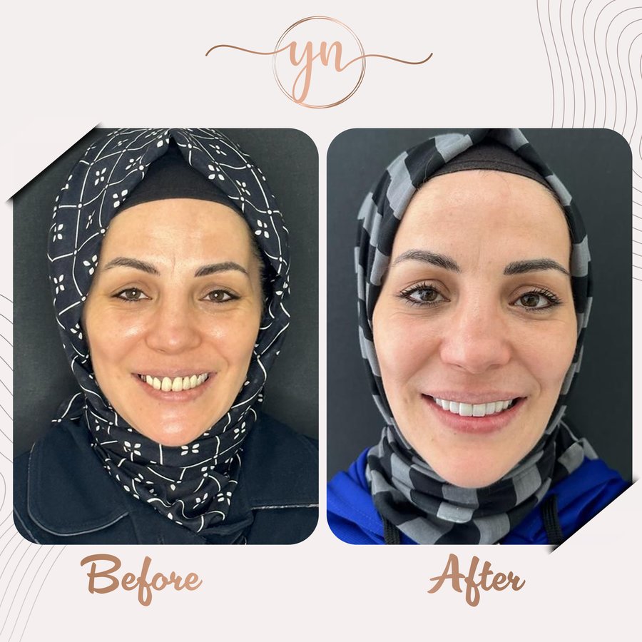 Yeni Nesil Dental Health Clinics - Yeni Nesil Dental Health Clinics