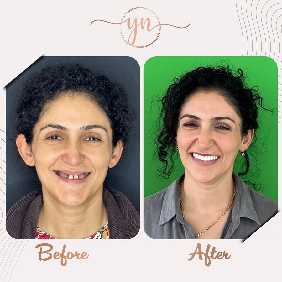 Yeni Nesil Dental Health Clinics - Yeni Nesil Dental Health Clinics