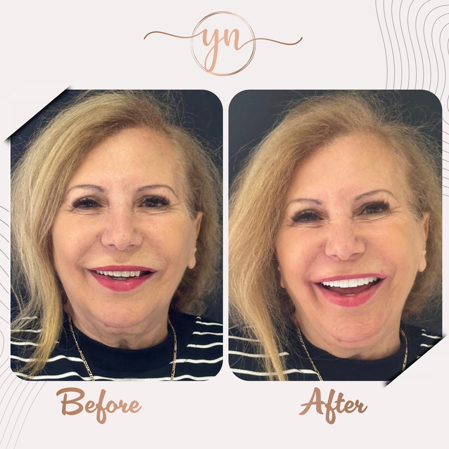 Yeni Nesil Dental Health Clinics - Yeni Nesil Dental Health Clinics