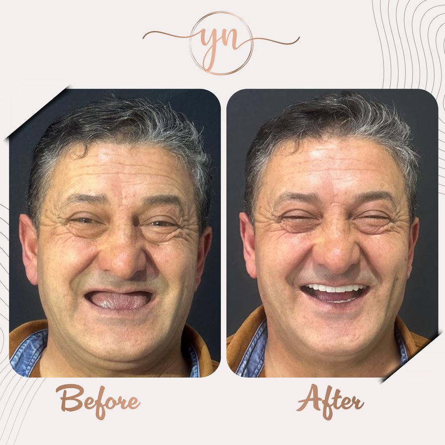 Yeni Nesil Dental Health Clinics - Yeni Nesil Dental Health Clinics