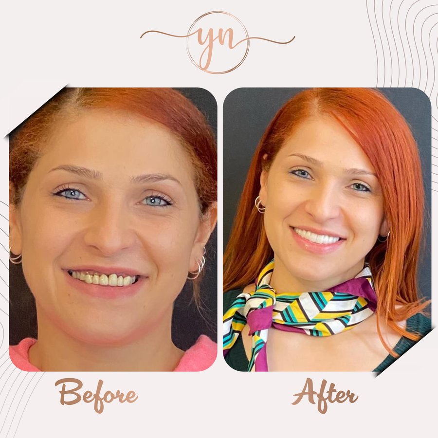 Yeni Nesil Dental Health Clinics - Yeni Nesil Dental Health Clinics