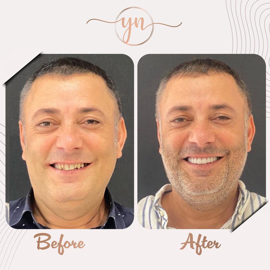 Yeni Nesil Dental Health Clinics - Yeni Nesil Dental Health Clinics