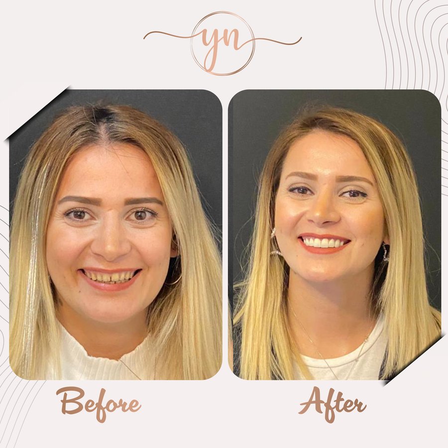 Yeni Nesil Dental Health Clinics - Yeni Nesil Dental Health Clinics