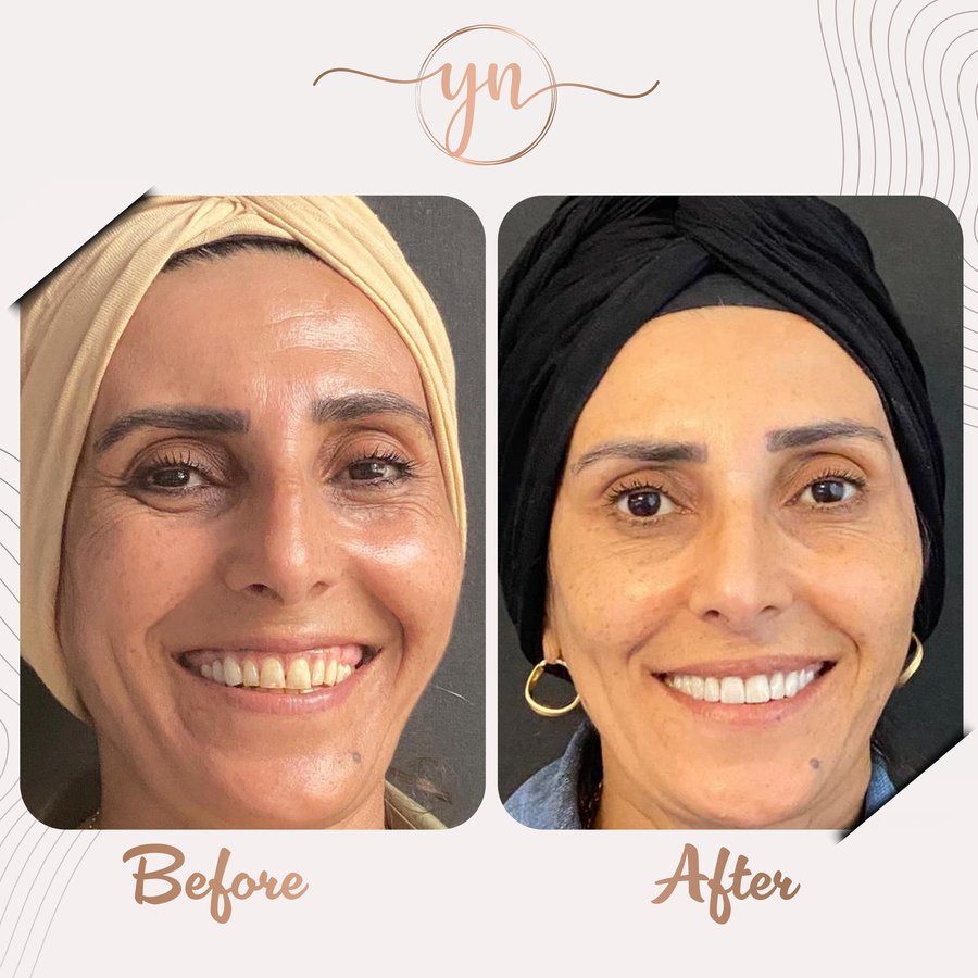 Yeni Nesil Dental Health Clinics - Yeni Nesil Dental Health Clinics