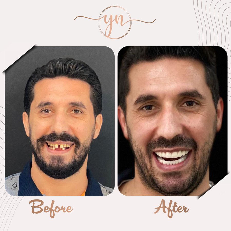 Yeni Nesil Dental Health Clinics - Yeni Nesil Dental Health Clinics