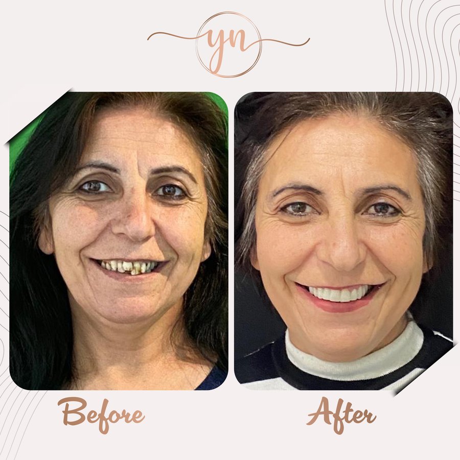 Yeni Nesil Dental Health Clinics - Yeni Nesil Dental Health Clinics