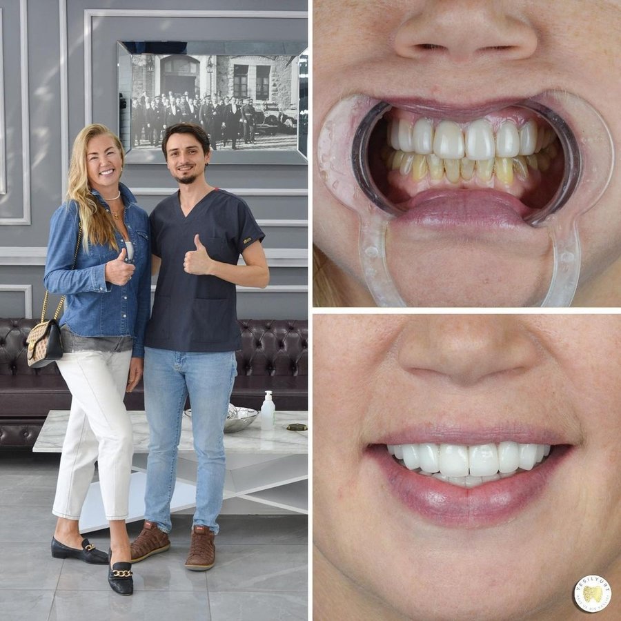 Yesilyurt Dental Clinic - Yesilyurt Dental Clinic