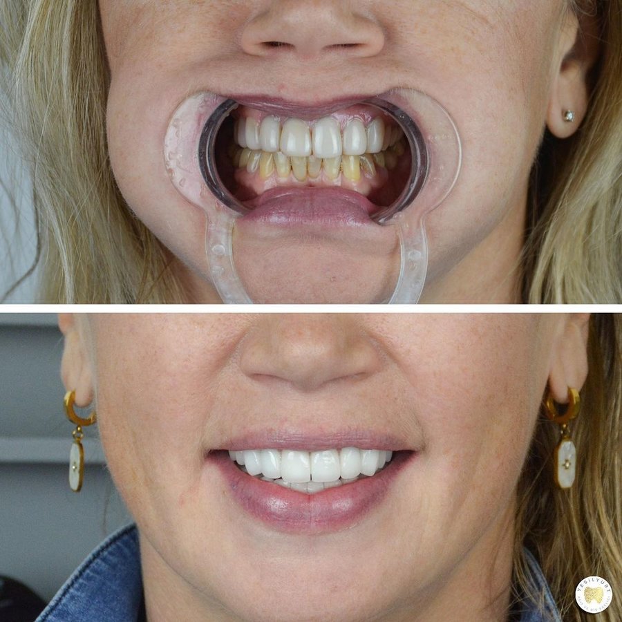 Yesilyurt Dental Clinic - Yesilyurt Dental Clinic