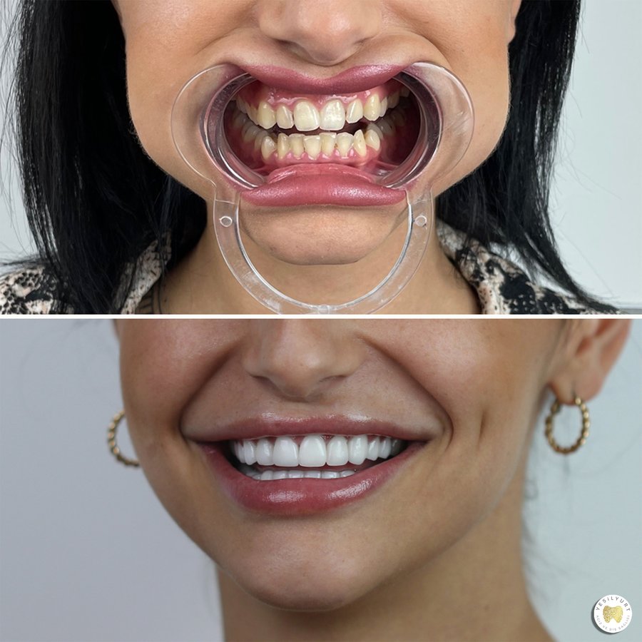 Yesilyurt Dental Clinic - Yesilyurt Dental Clinic