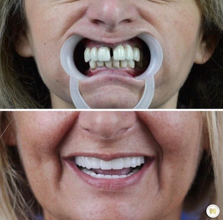 Yesilyurt Dental Clinic - Yesilyurt Dental Clinic