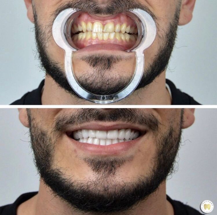 Yesilyurt Dental Clinic - Yesilyurt Dental Clinic