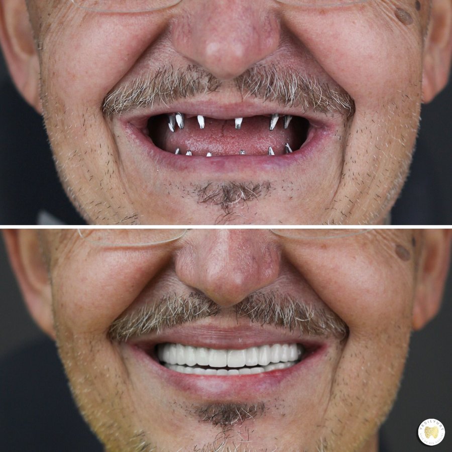 Yesilyurt Dental Clinic - Yesilyurt Dental Clinic