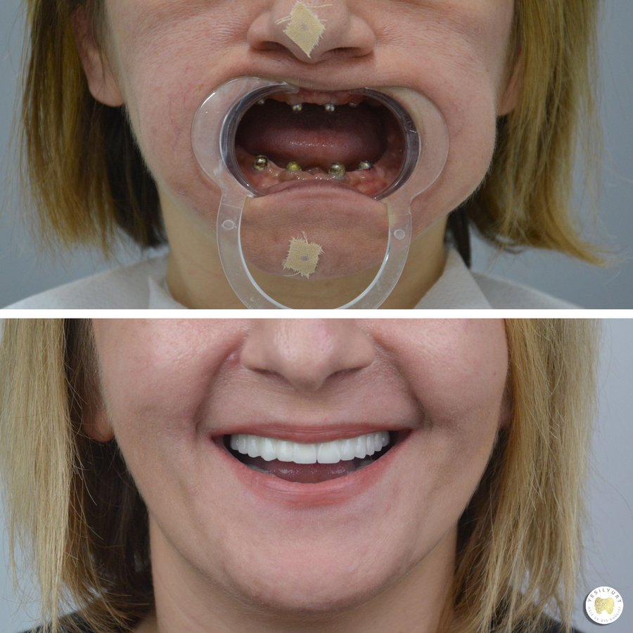 Yesilyurt Dental Clinic - Yesilyurt Dental Clinic