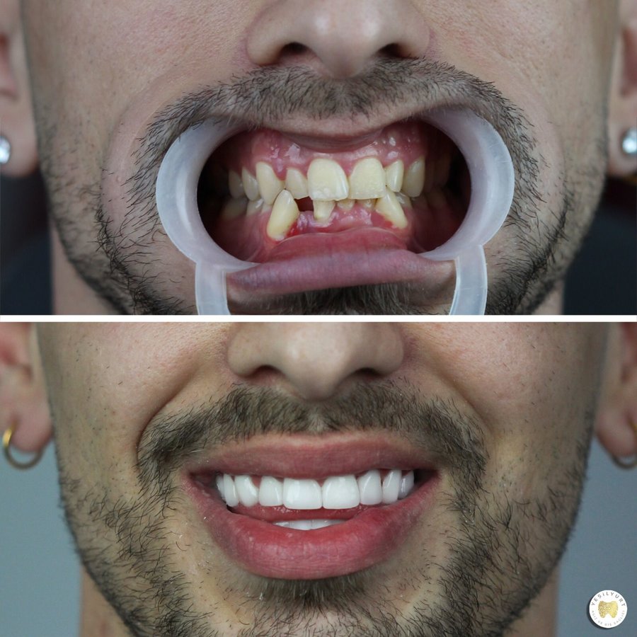 Yesilyurt Dental Clinic - Yesilyurt Dental Clinic