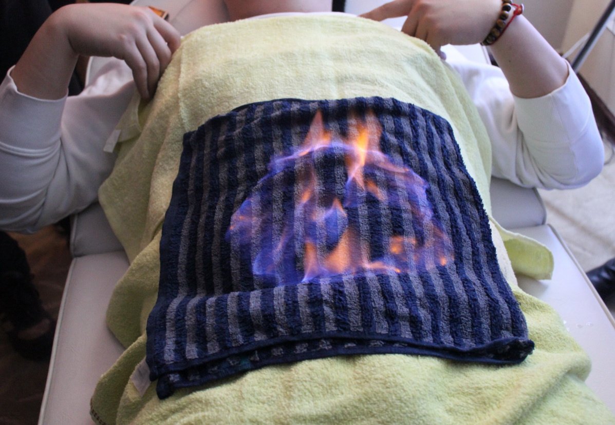 Yin Yang Acupuncture Clinic - Yin Yang Acupuncture Clinic