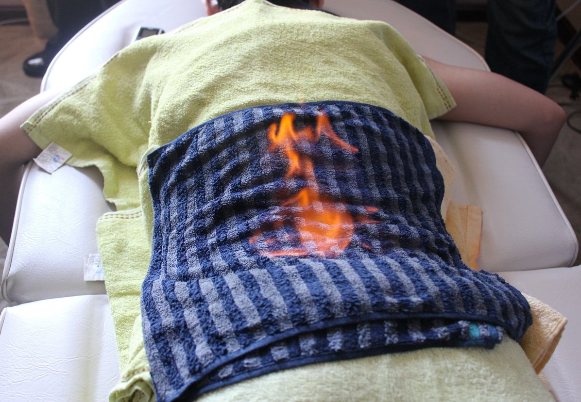 Yin Yang Acupuncture Clinic - Yin Yang Acupuncture Clinic