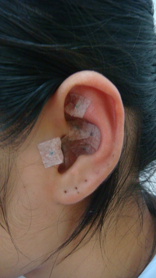 Yin Yang Acupuncture Clinic - Yin Yang Acupuncture Clinic