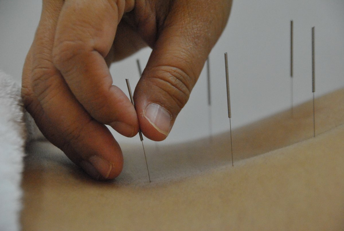 Yin Yang Acupuncture Clinic - Yin Yang Acupuncture Clinic