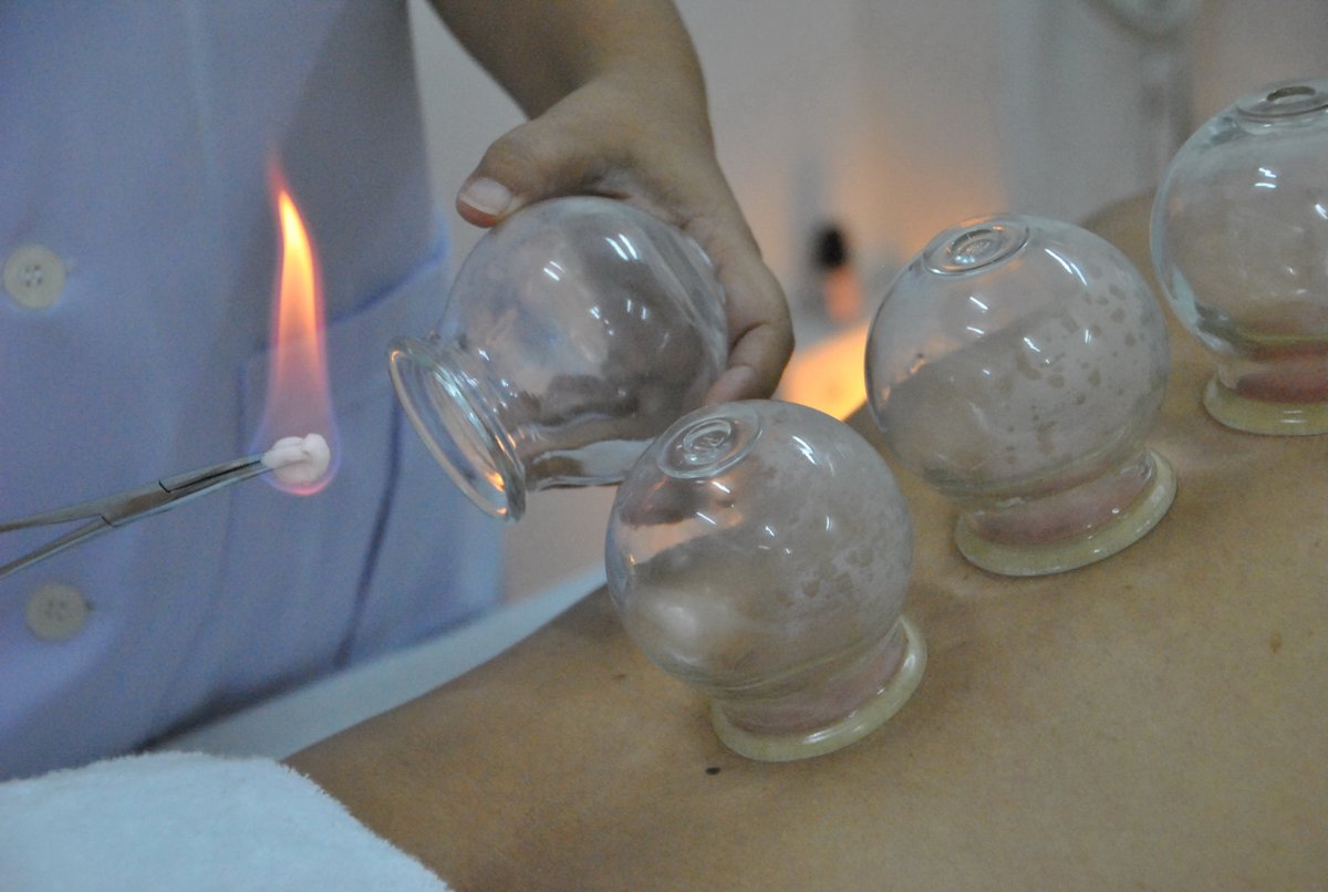 Yin Yang Acupuncture Clinic - Yin Yang Acupuncture Clinic