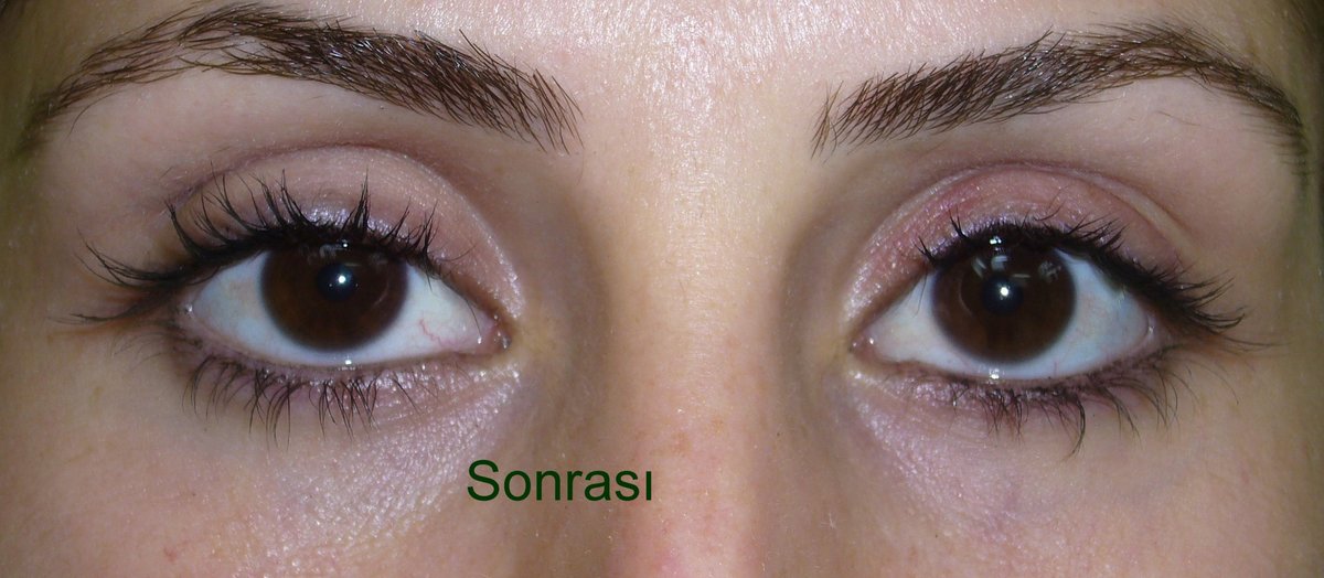 YNG Bodrum Medlife Klinik - YNG Bodrum Medlife Klinik