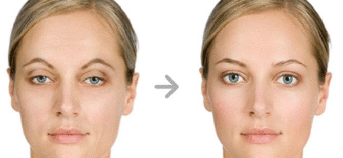 YNG Bodrum Medlife Klinik - YNG Bodrum Medlife Klinik