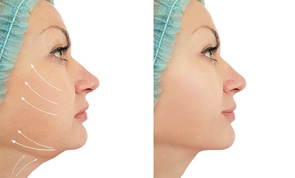 YNG Bodrum Medlife Klinik - YNG Bodrum Medlife Klinik