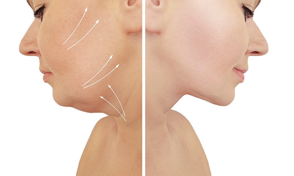 YNG Bodrum Medlife Klinik - YNG Bodrum Medlife Klinik