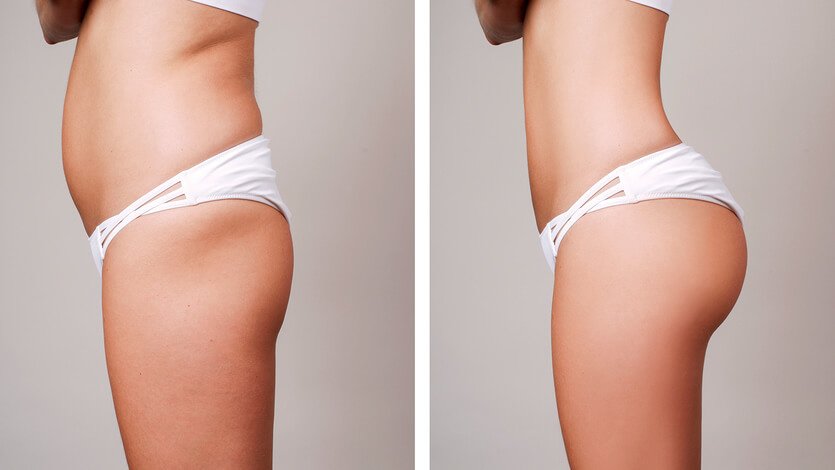 YNG Bodrum Medlife Klinik - YNG Bodrum Medlife Klinik