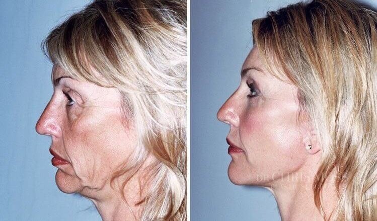 YNG Bodrum Medlife Klinik - YNG Bodrum Medlife Klinik