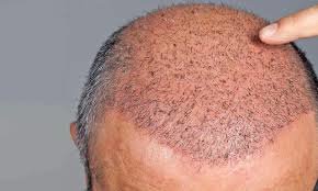 YNG Bodrum Medlife Klinik - YNG Bodrum Medlife Klinik