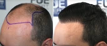 YNG Bodrum Medlife Klinik - YNG Bodrum Medlife Klinik