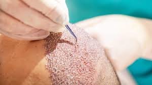 YNG Bodrum Medlife Klinik - YNG Bodrum Medlife Klinik