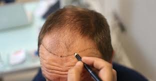 YNG Bodrum Medlife Klinik - YNG Bodrum Medlife Klinik