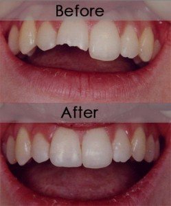 YNG Bodrum Medlife Klinik - YNG Bodrum Medlife Klinik