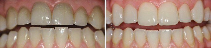 YNG Bodrum Medlife Klinik - YNG Bodrum Medlife Klinik