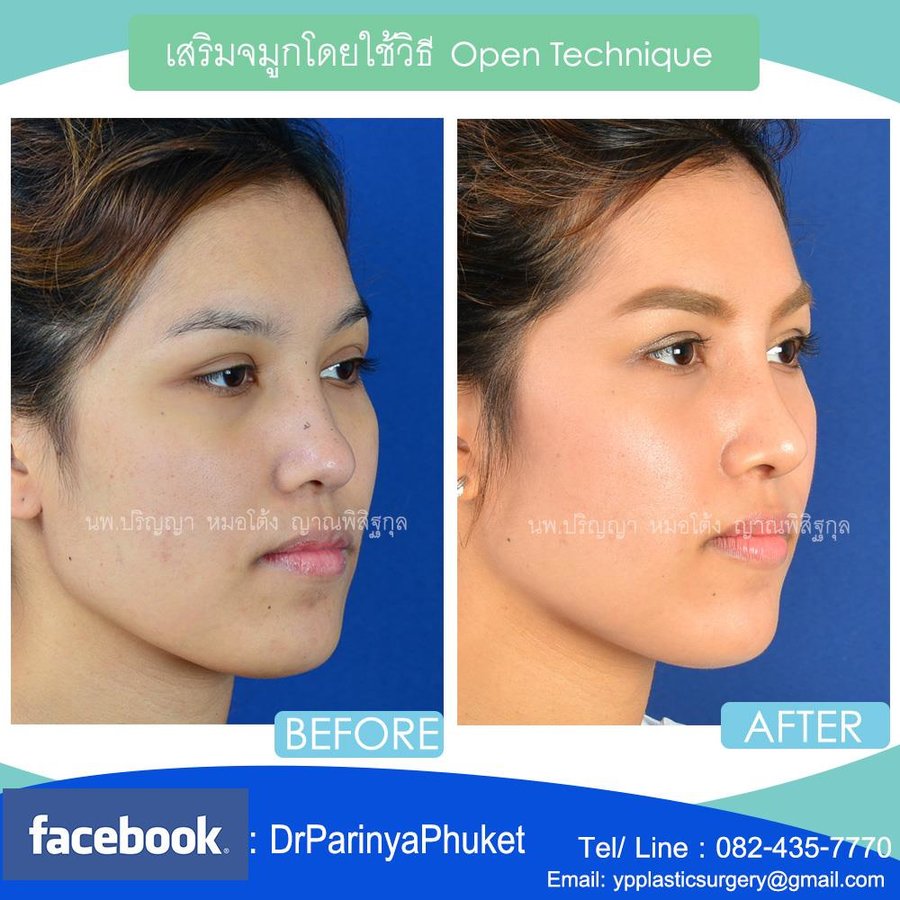 YP Plastic Surgery Clinic - YP Plastic Surgery Clinic