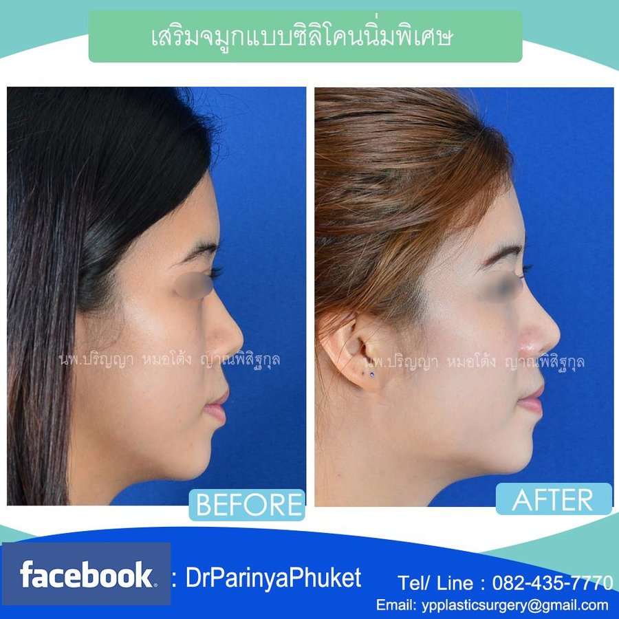 YP Plastic Surgery Clinic - YP Plastic Surgery Clinic