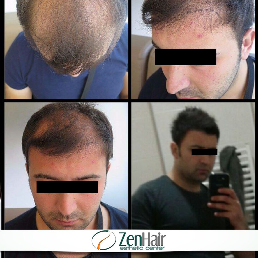 Zen Hair Esthetic Center - Zen Hair Esthetic Center