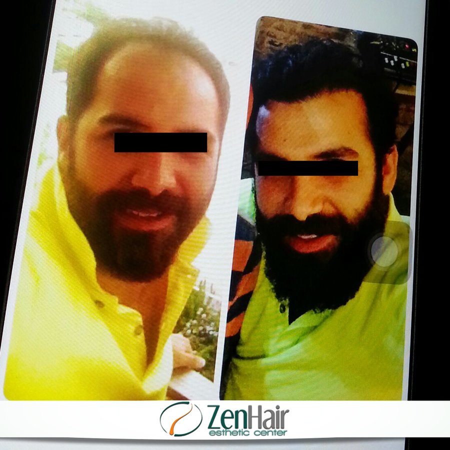 Zen Hair Esthetic Center - Zen Hair Esthetic Center
